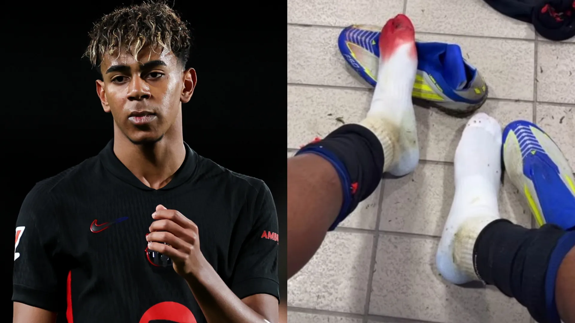 Blut im Schuh, aber kein Foul: Lamine Yamal vom FC Barcelona