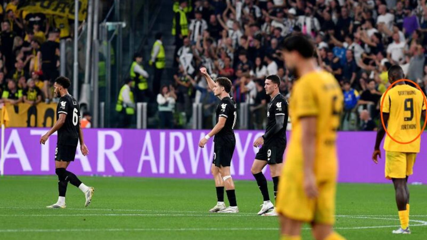 BVB gegen Juventus: Guirassys Trikot gibt Rätsel auf